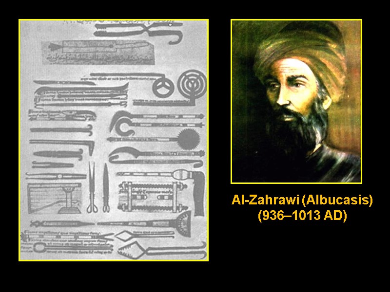 Al-Zahrawi (Albucasis) (936–1013 AD)